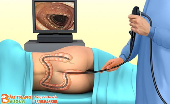 Bác sĩ nội soi đại tràng đề chẩn đoán