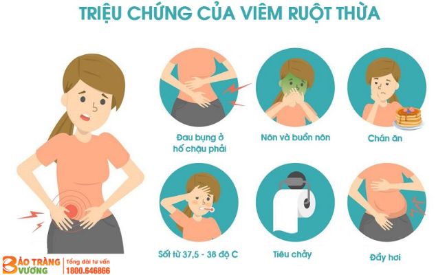 Một số triệu chứng của bệnh viêm ruột thừa