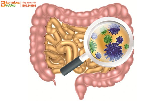 Mất cân bằng hệ vi sinh đường ruột là một trong những nguyên nhân gây rối loạn tiêu hóa