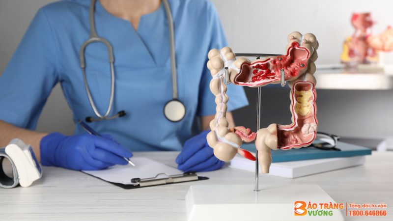 Ung thư đại tràng là bệnh khá phổ biến ở Việt Nam